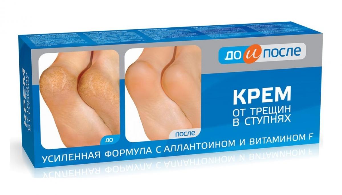 ДО И ПОСЛЕ КРЕМ ОТ ТРЕЩИН В СТУПНЯХ 150МЛ
