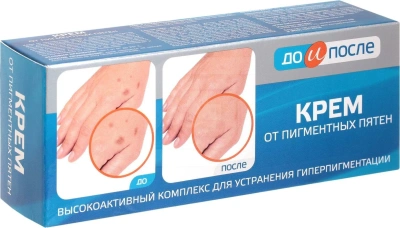 ДО И ПОСЛЕ КРЕМ ОТ ПИГМЕНТНЫХ ПЯТЕН 50МЛ фото в интернет-аптеке Склад Лекарств